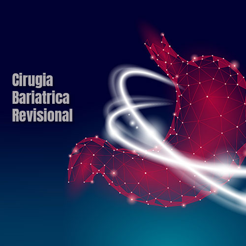 Cirugía Bariátrica Revisional