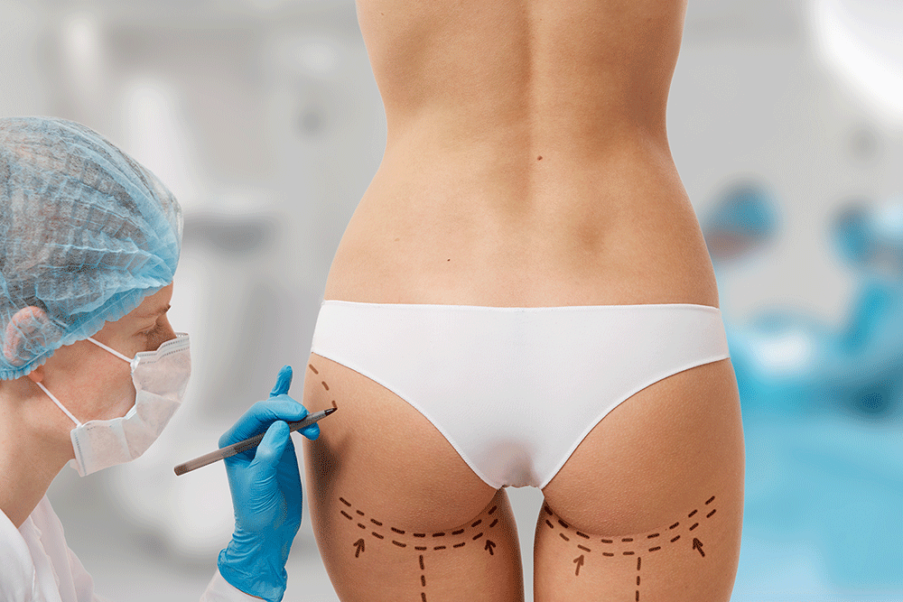 cirugía plástica en colombia abdominoplastia aumento de senos reduccion de senos lipo cirugia plastica facial en colombia cirujanos plasticos