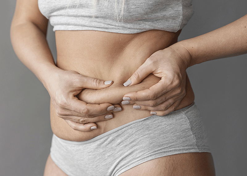 Mujer con sobrantes de piel en abdomen lipo escultura