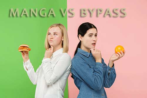 elegir entre el bypass y la manga gastrica manga vs bypass ventajas y desventajas pros y contras cirugia bariátrica en Colombia