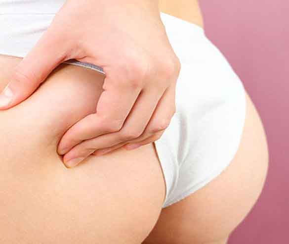 gluteoplastia con grasa