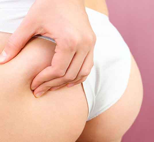 GLUTEOPLASTIA NALGAS