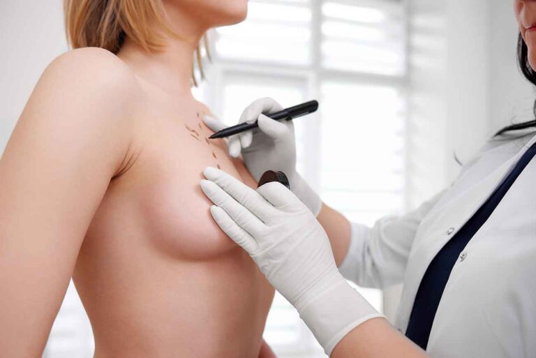 Riesgos y posibles complicaciones de la cirugía plástica reducción de senos mamoplastia de reducción infeccion sangrado dolor