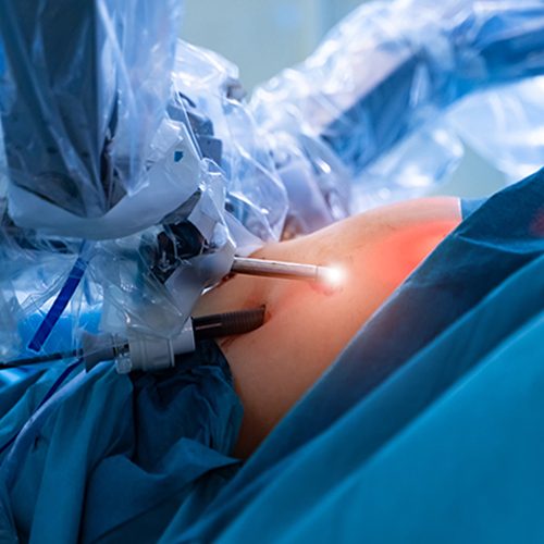quirofano cirugia robotica porstatectomia